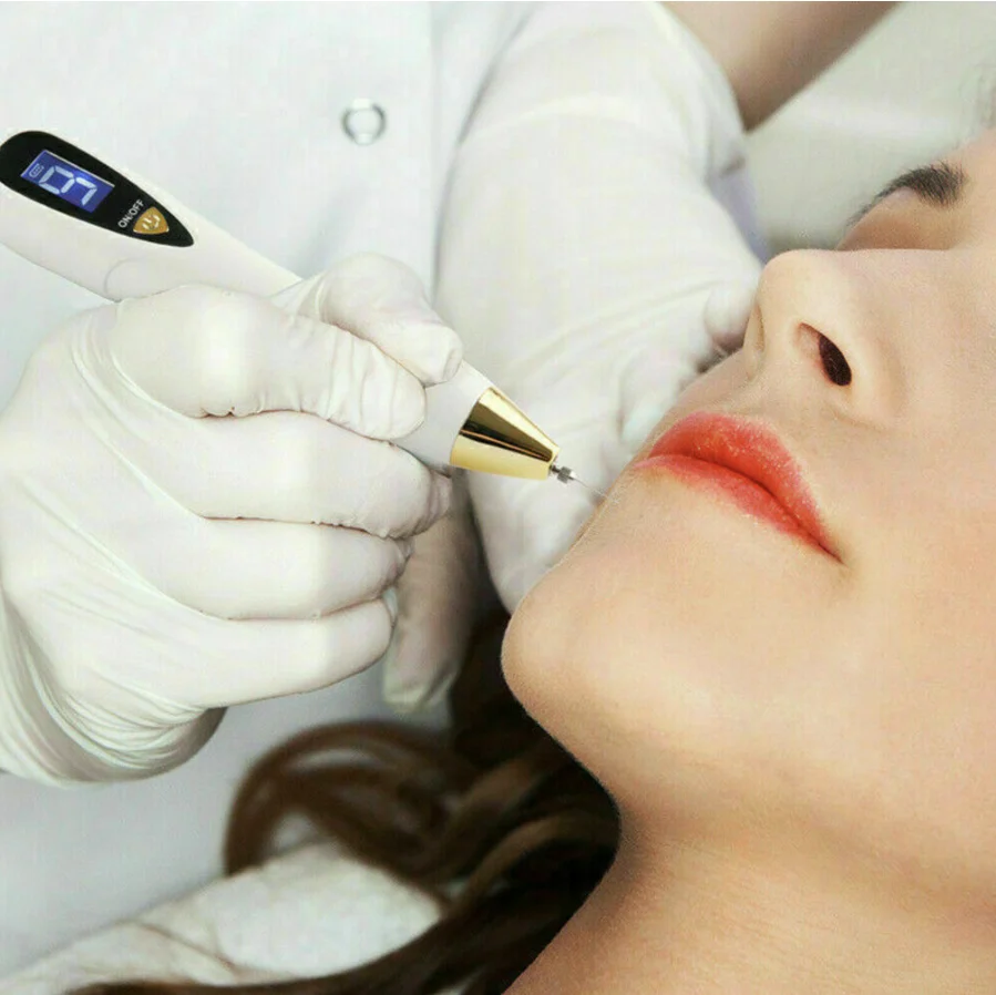 Plasma Pen Mole - Imagen 8