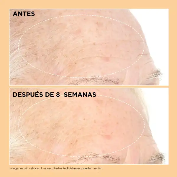 Neuropeptide Pro-Strength Firming Moisturizer - Imagen 5