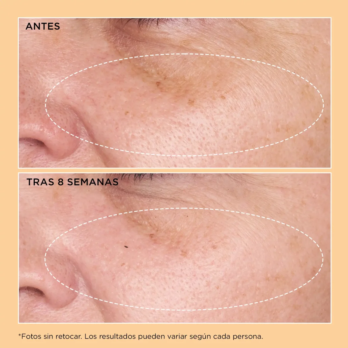 Neuropeptide Rejuvenating Moisturizer High Protection SPF 25 - Imagen 5